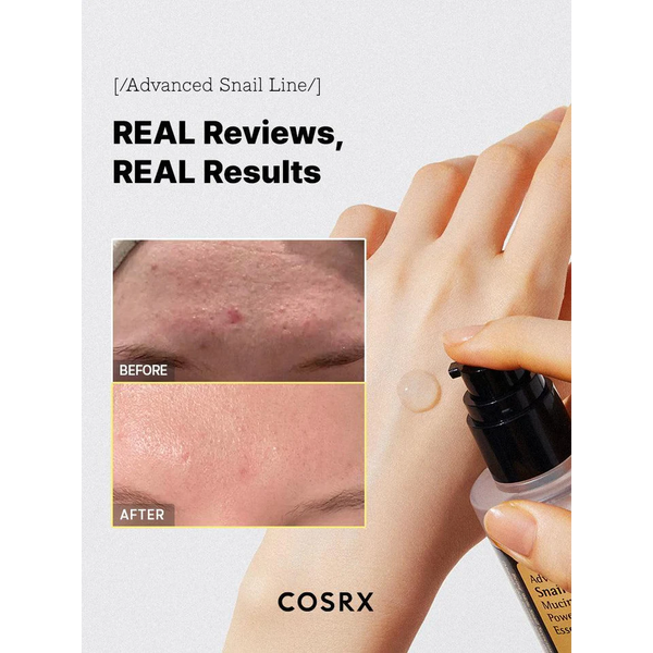 Cosrx - Advanced Snail 96 Mucin Power Essence
