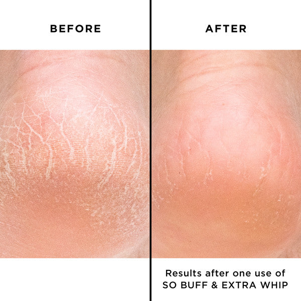 butter LONDON - Extra Whip Hand and Foot Treatment with Shea Butter