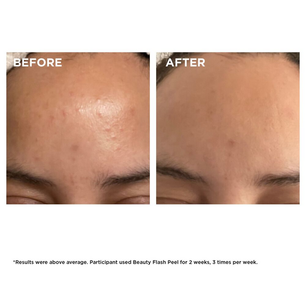 Clarins - Beauty Flash Peel 50Ml