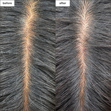 Briogeo - Scalp Revival Charcoal + Tea Tree Scalp Treatment 1 oz Drops