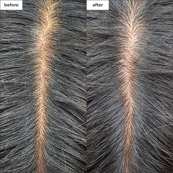 Briogeo - Scalp Revival Charcoal + Tea Tree Scalp Treatment 1 oz Drops