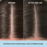 Briogeo - Scalp Revival Charcoal + Tea Tree Scalp Treatment 1 oz Drops
