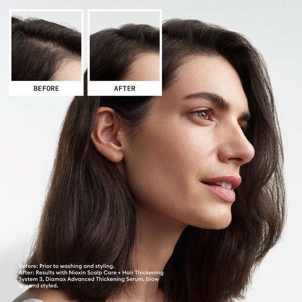 Nioxin - Scalp + Hair Thickening System 3 Leave on Treatment 100 ML
