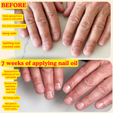 Nail Thoughts - Nail Oil - Summer Forever