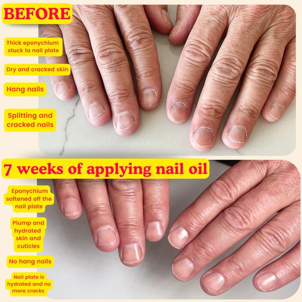 Nail Thoughts - Nail Oil - Summer Forever